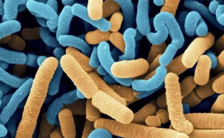 益生菌和乳酸菌有什么不同
